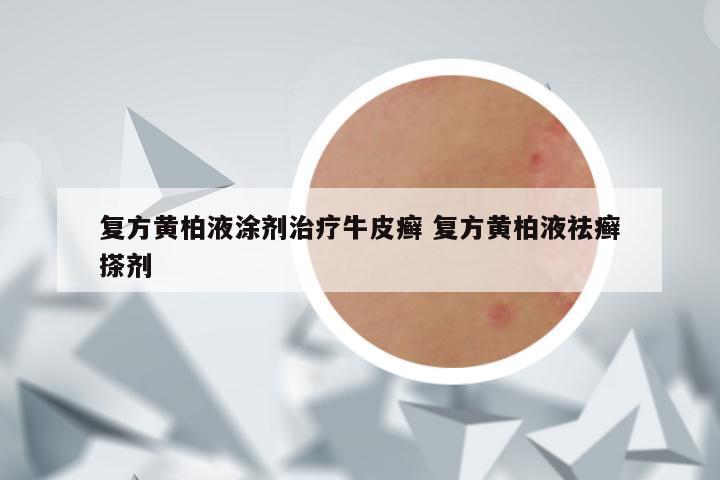 复方黄柏液涂剂治疗牛皮癣 复方黄柏液祛癣搽剂