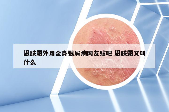 恩肤霜外用全身银屑病网友贴吧 恩肤霜又叫什么