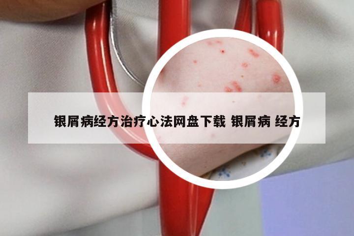 银屑病经方治疗心法网盘下载 银屑病 经方