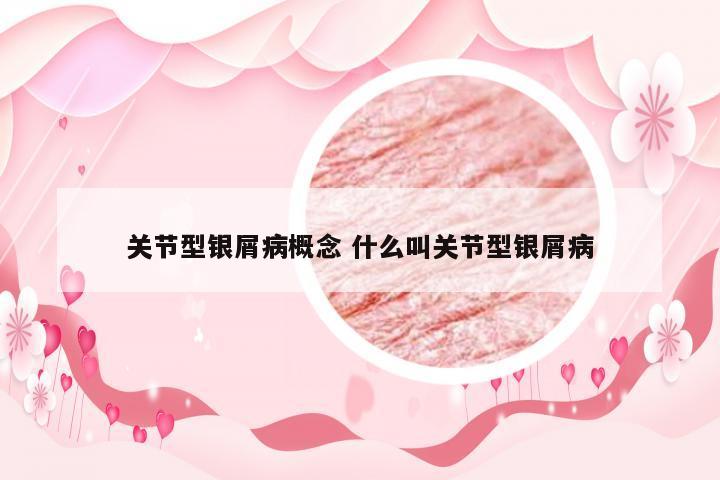 关节型银屑病概念 什么叫关节型银屑病