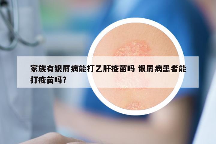 家族有银屑病能打乙肝疫苗吗 银屑病患者能打疫苗吗?