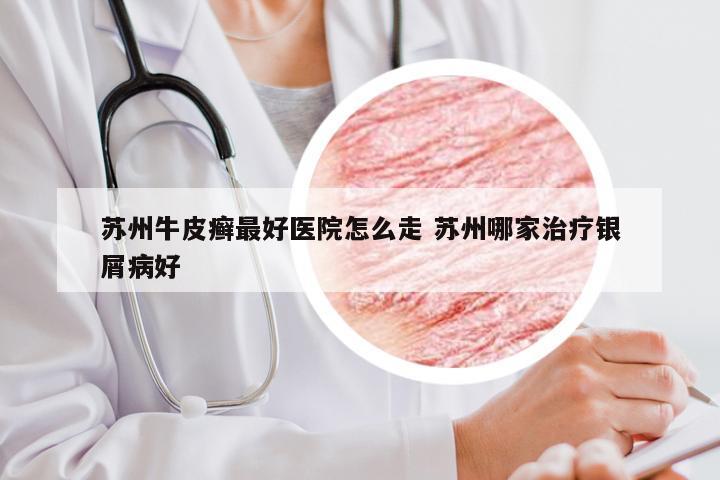 苏州牛皮癣最好医院怎么走 苏州哪家治疗银屑病好