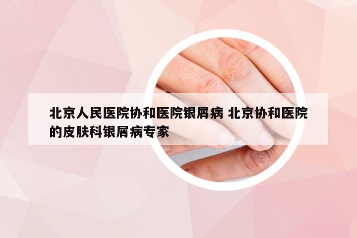 北京人民医院协和医院银屑病 北京协和医院的皮肤科银屑病专家