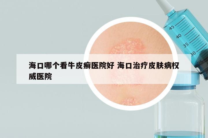 海口哪个看牛皮癣医院好 海口治疗皮肤病权威医院