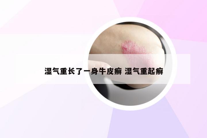 湿气重长了一身牛皮癣 湿气重起癣