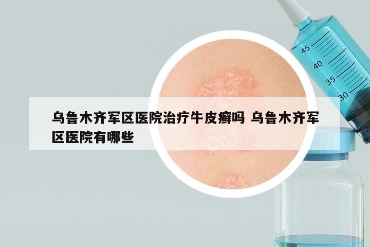 乌鲁木齐军区医院治疗牛皮癣吗 乌鲁木齐军区医院有哪些