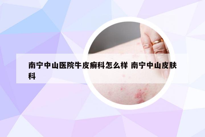 南宁中山医院牛皮癣科怎么样 南宁中山皮肤科