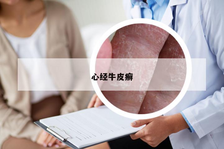心经牛皮癣