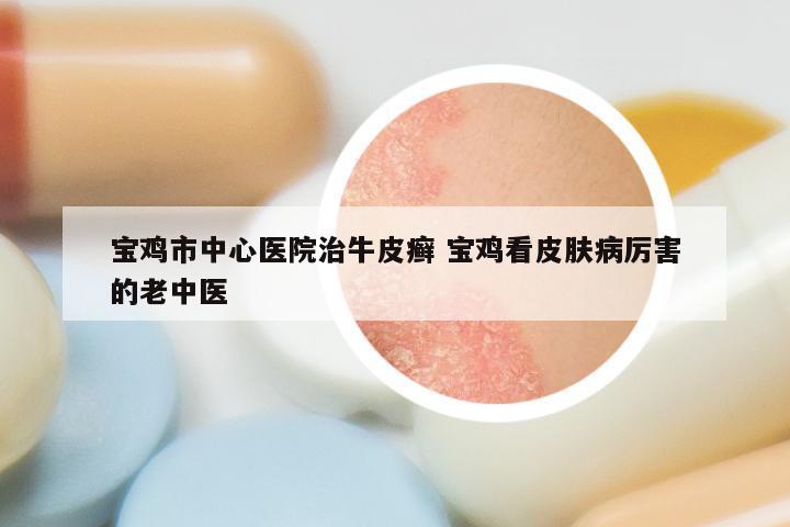 宝鸡市中心医院治牛皮癣 宝鸡看皮肤病厉害的老中医