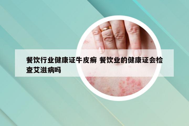 餐饮行业健康证牛皮癣 餐饮业的健康证会检查艾滋病吗