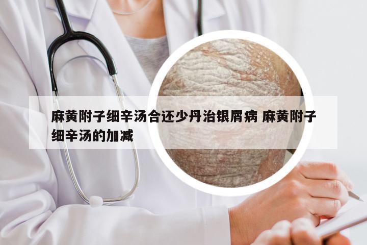 麻黄附子细辛汤合还少丹治银屑病 麻黄附子细辛汤的加减