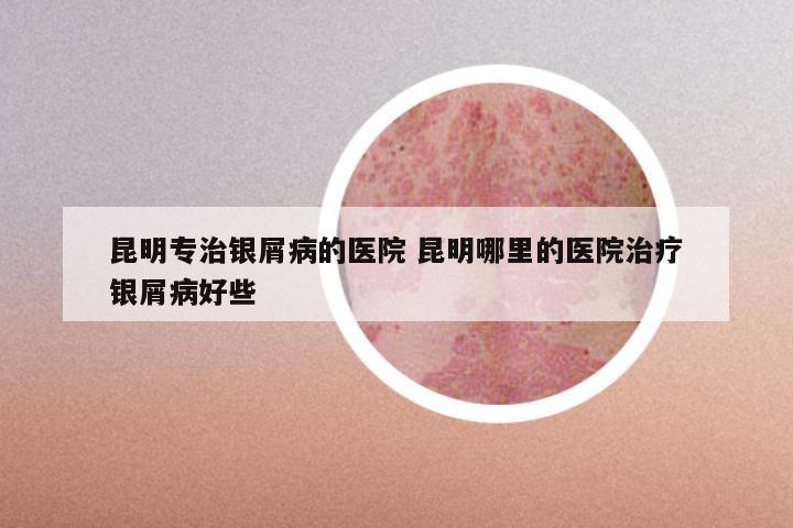 昆明专治银屑病的医院 昆明哪里的医院治疗银屑病好些