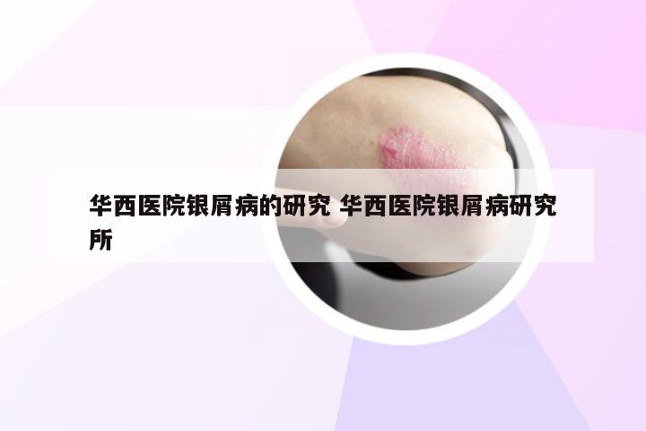 华西医院银屑病的研究 华西医院银屑病研究所