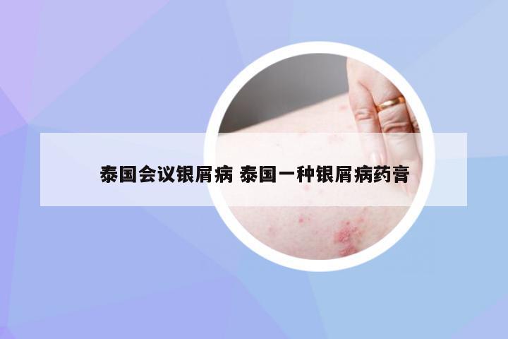 泰国会议银屑病 泰国一种银屑病药膏