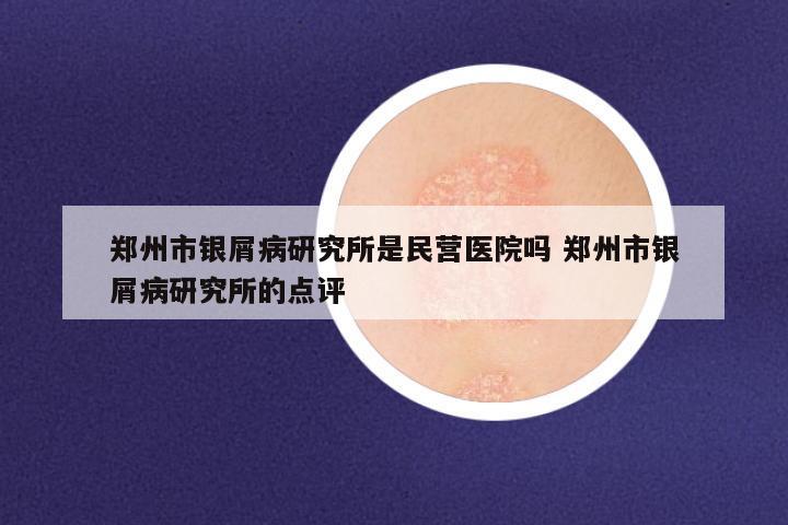 郑州市银屑病研究所是民营医院吗 郑州市银屑病研究所的点评