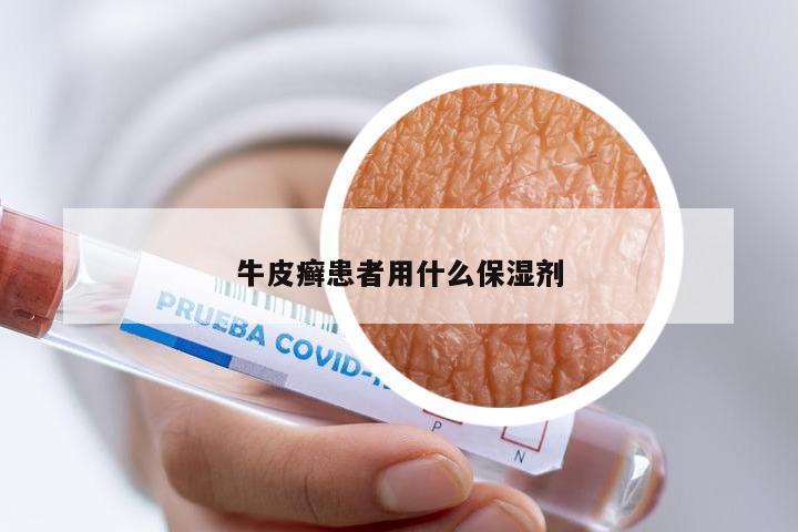 牛皮癣患者用什么保湿剂