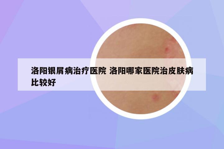 洛阳银屑病治疗医院 洛阳哪家医院治皮肤病比较好