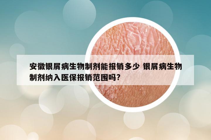 安徽银屑病生物制剂能报销多少 银屑病生物制剂纳入医保报销范围吗?