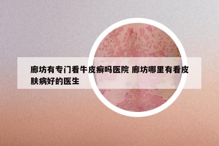 廊坊有专门看牛皮癣吗医院 廊坊哪里有看皮肤病好的医生