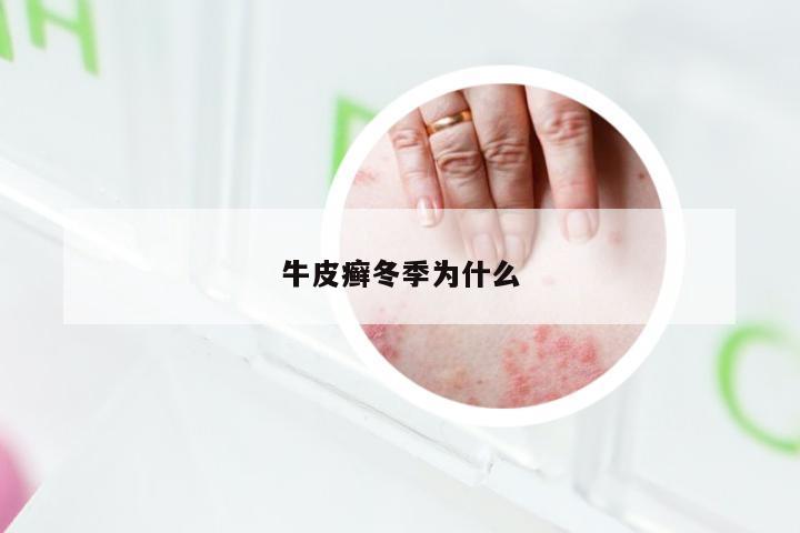 牛皮癣冬季为什么