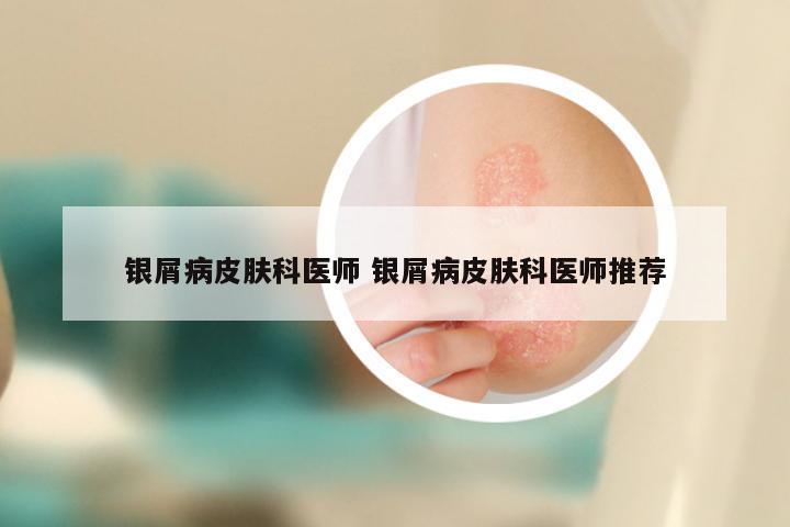 银屑病皮肤科医师 银屑病皮肤科医师推荐