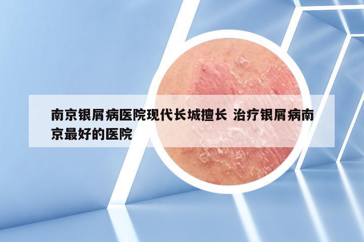 南京银屑病医院现代长城擅长 治疗银屑病南京最好的医院