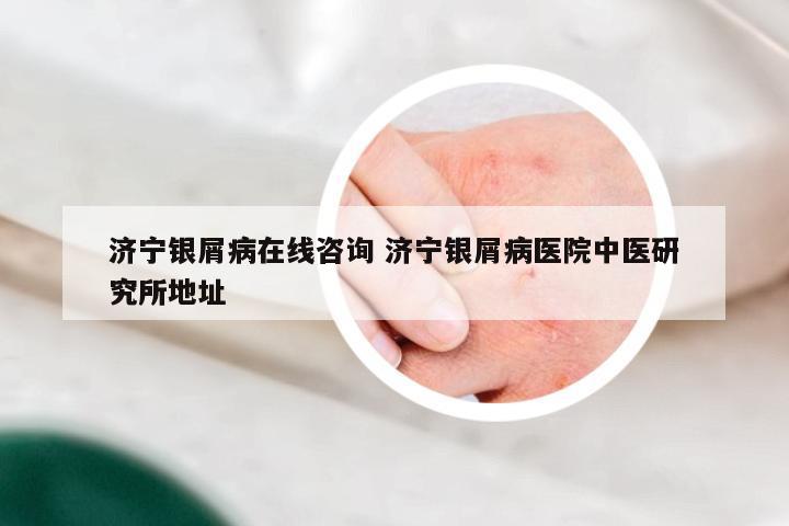 济宁银屑病在线咨询 济宁银屑病医院中医研究所地址