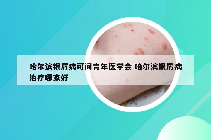 哈尔滨银屑病可问青年医学会 哈尔滨银屑病治疗哪家好