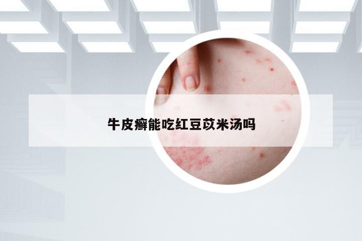 牛皮癣能吃红豆苡米汤吗