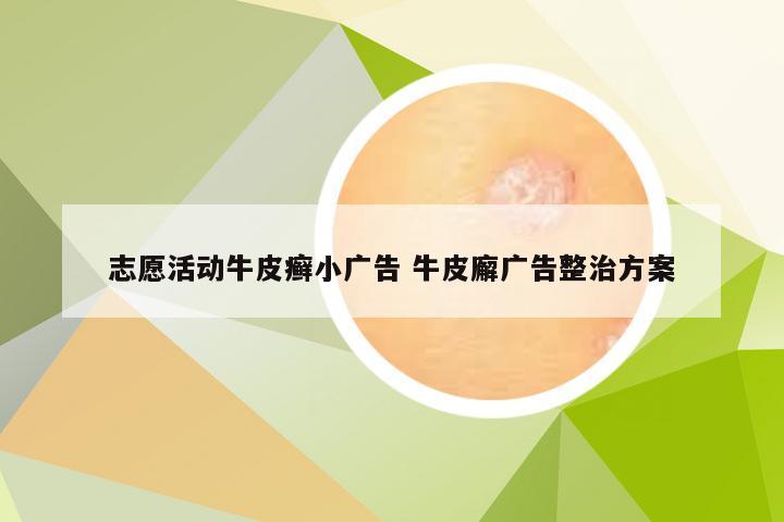 志愿活动牛皮癣小广告 牛皮廨广告整治方案