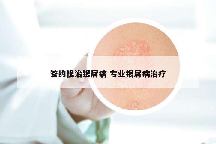 签约根治银屑病 专业银屑病治疗
