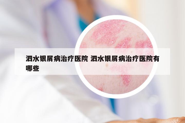 泗水银屑病治疗医院 泗水银屑病治疗医院有哪些