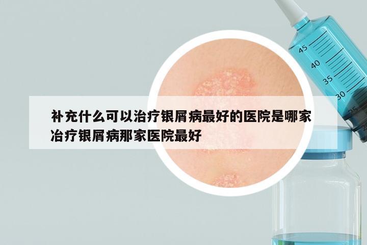 补充什么可以治疗银屑病最好的医院是哪家 冶疗银屑病那家医院最好