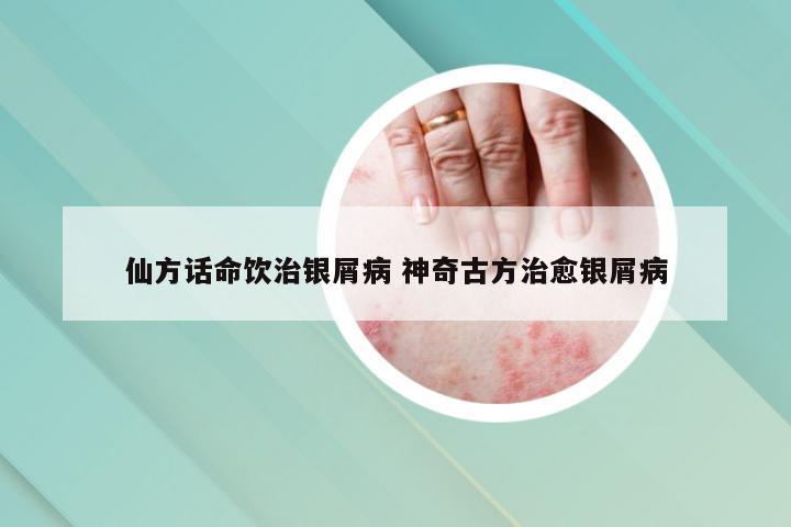 仙方话命饮治银屑病 神奇古方治愈银屑病