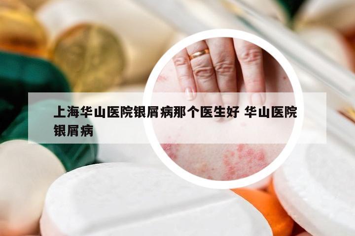 上海华山医院银屑病那个医生好 华山医院 银屑病