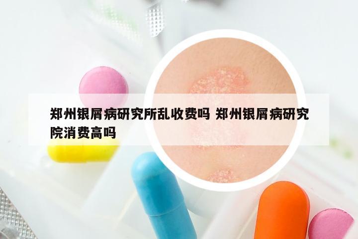 郑州银屑病研究所乱收费吗 郑州银屑病研究院消费高吗