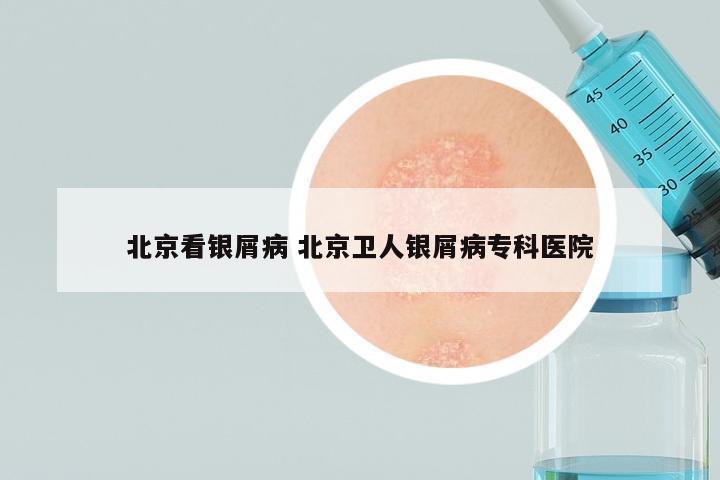 北京看银屑病 北京卫人银屑病专科医院