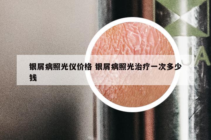 银屑病照光仪价格 银屑病照光治疗一次多少钱