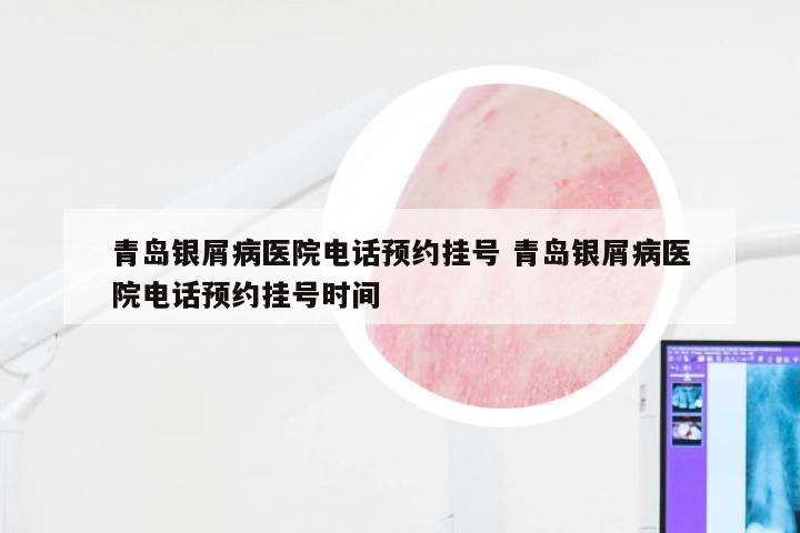 青岛银屑病医院电话预约挂号 青岛银屑病医院电话预约挂号时间