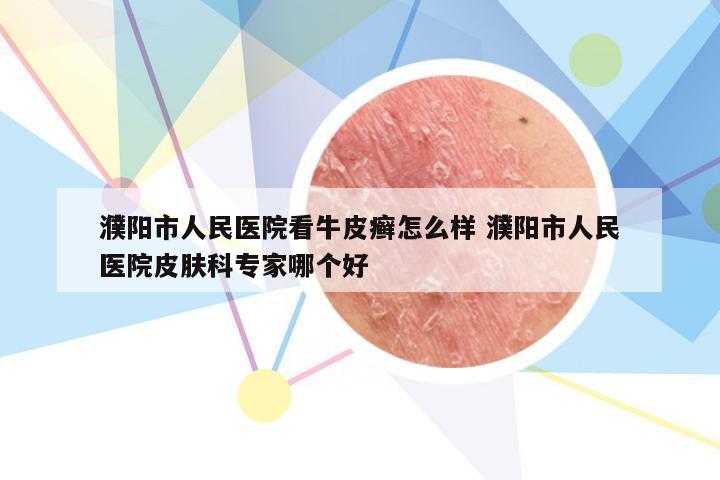 濮阳市人民医院看牛皮癣怎么样 濮阳市人民医院皮肤科专家哪个好