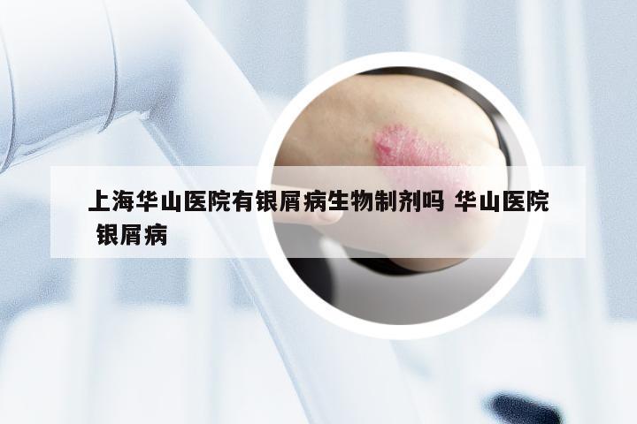 上海华山医院有银屑病生物制剂吗 华山医院 银屑病