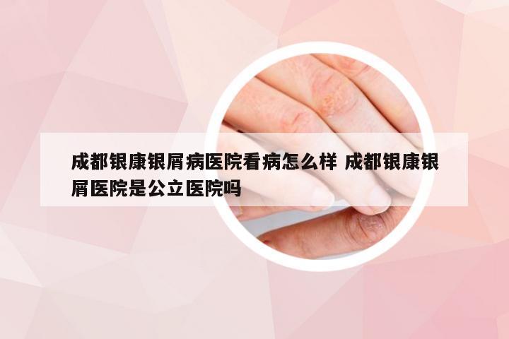 成都银康银屑病医院看病怎么样 成都银康银屑医院是公立医院吗