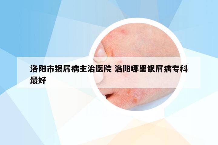 洛阳市银屑病主治医院 洛阳哪里银屑病专科最好