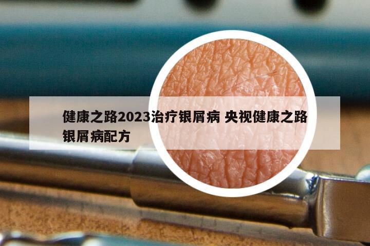 健康之路2023治疗银屑病 央视健康之路银屑病配方