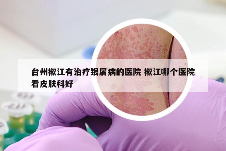 台州椒江有治疗银屑病的医院 椒江哪个医院看皮肤科好