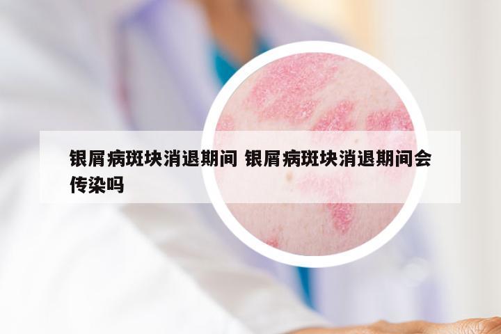 银屑病斑块消退期间 银屑病斑块消退期间会传染吗