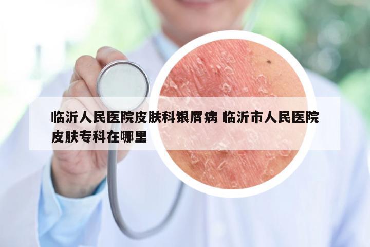 临沂人民医院皮肤科银屑病 临沂市人民医院皮肤专科在哪里
