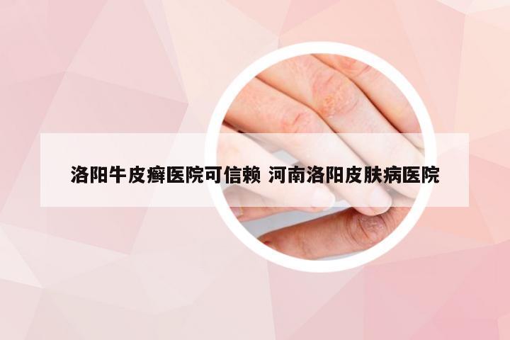 洛阳牛皮癣医院可信赖 河南洛阳皮肤病医院