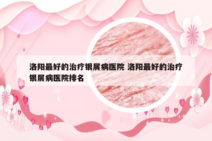 洛阳最好的治疗银屑病医院 洛阳最好的治疗银屑病医院排名