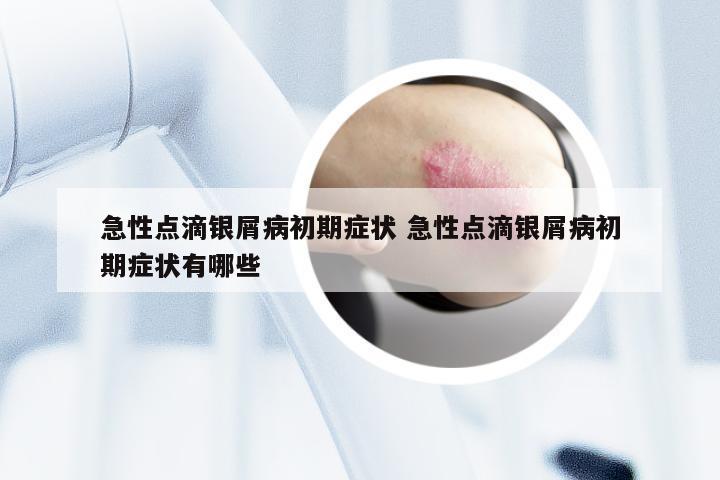 急性点滴银屑病初期症状 急性点滴银屑病初期症状有哪些